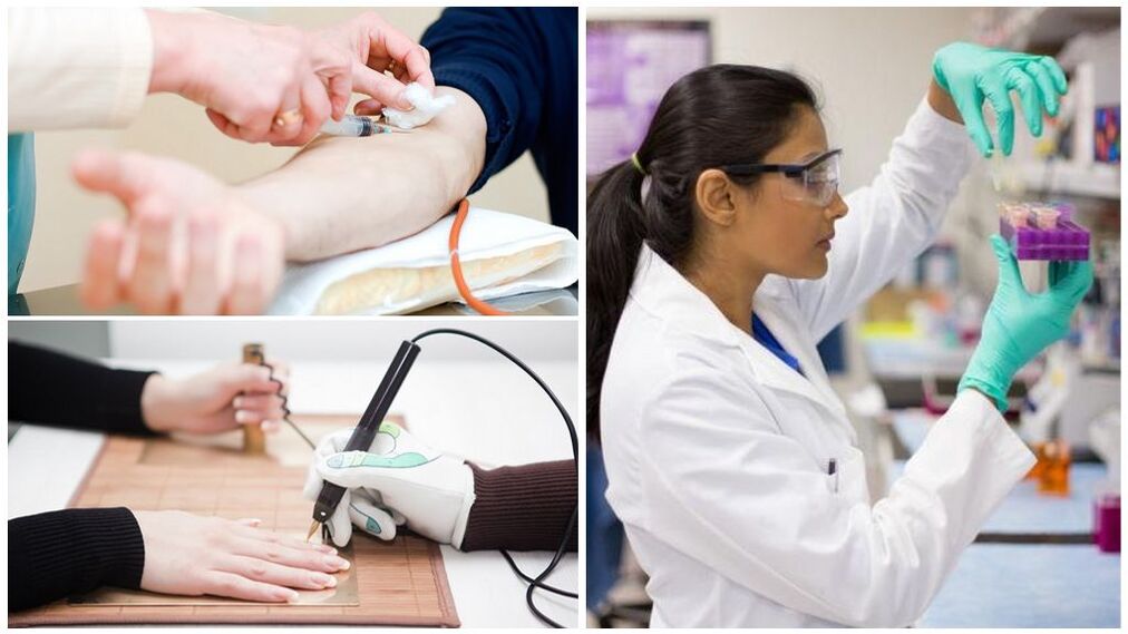 Дијагностички методи за откривање на паразити во телото