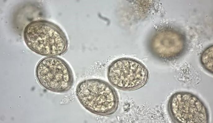 паразити под микроскоп